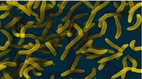 微生物菌劑好？好在哪里您知道嗎？